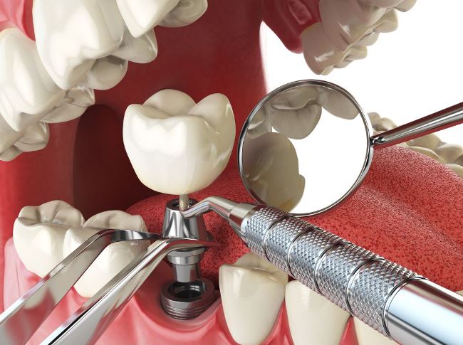 clínica dental en Vilafranca del Penedés