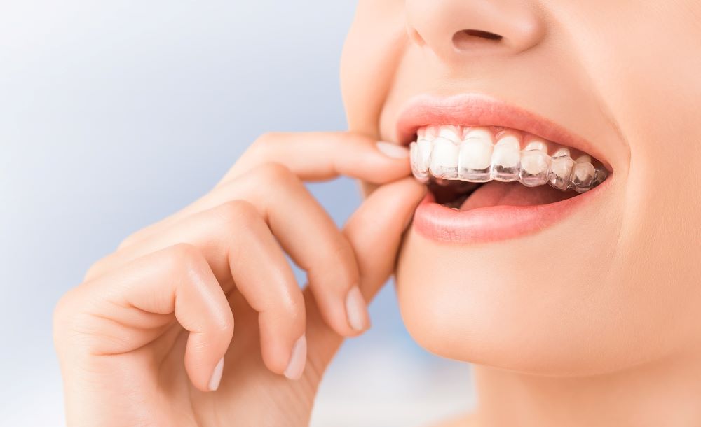 ortodoncia invisalign